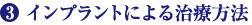 3）インプラントによる治療方法