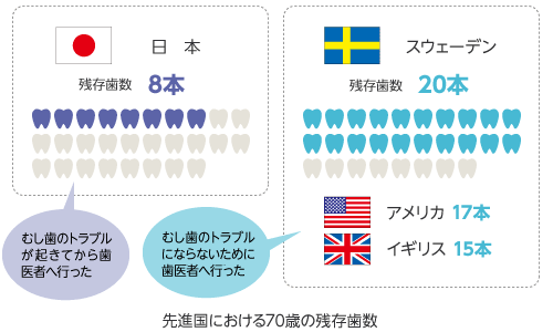 先進国における70歳の残存歯数(スウェーデン20本、アメリカ17本、イギリス15本に対して、日本は8本)